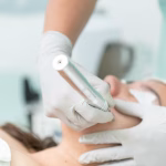 Hyperpigmentation Laser Treatment: A Complete Guide to Clear, Even-Toned Skin