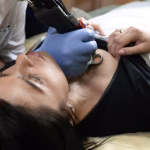 Cosmetic Laser Treatment