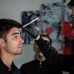 Laser Treatment for Rosacea