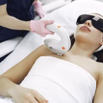 Pico Laser Treatment