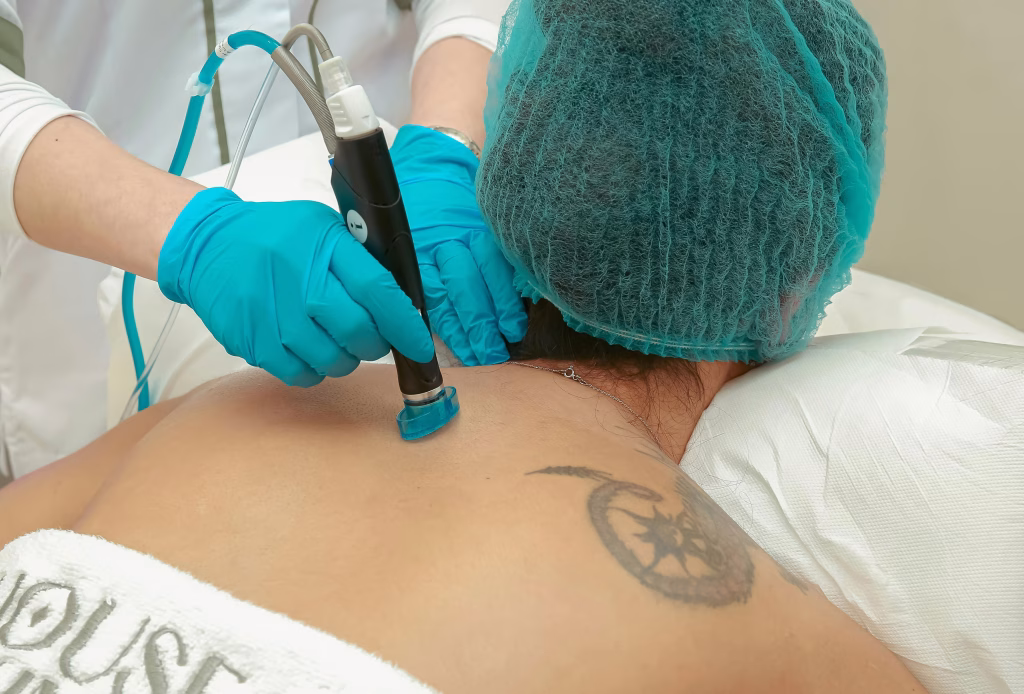 laser treatment for toenail fungus