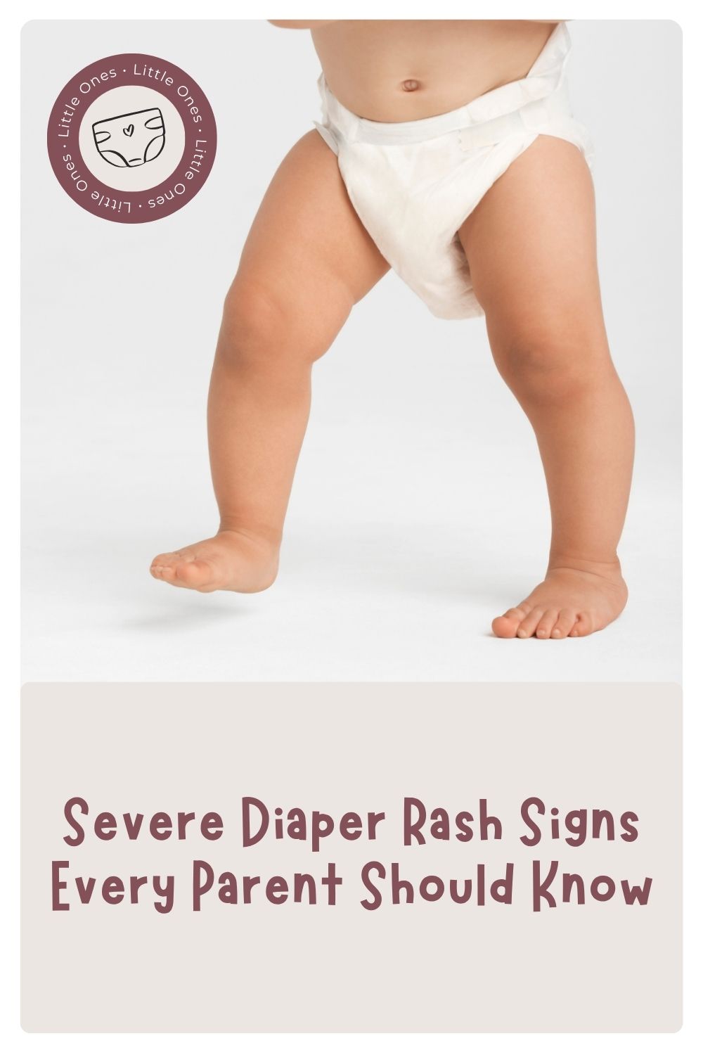 Severe Diaper Rash