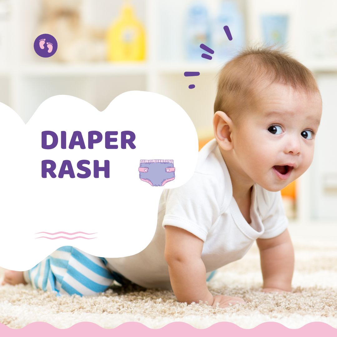Diaper Rash
