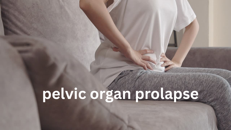 Pelvic Organ Prolapse: Symptoms, Causes & Treatment Options (2026 Guide)
